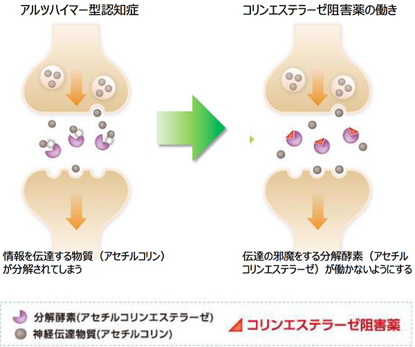 アリセプトの作用機序